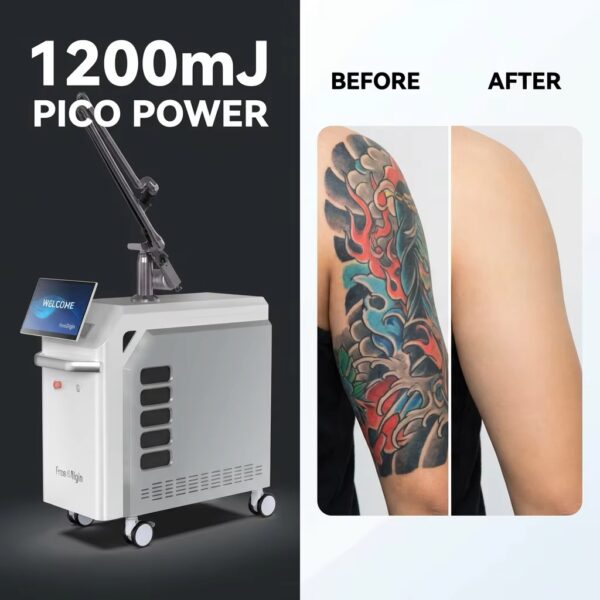Picosecond Laser Machine Technology