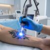 Picosecond Laser Machine Technology