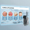Long Pulse 1064nm & Alex 755nm Dual-Wavelength Laser System